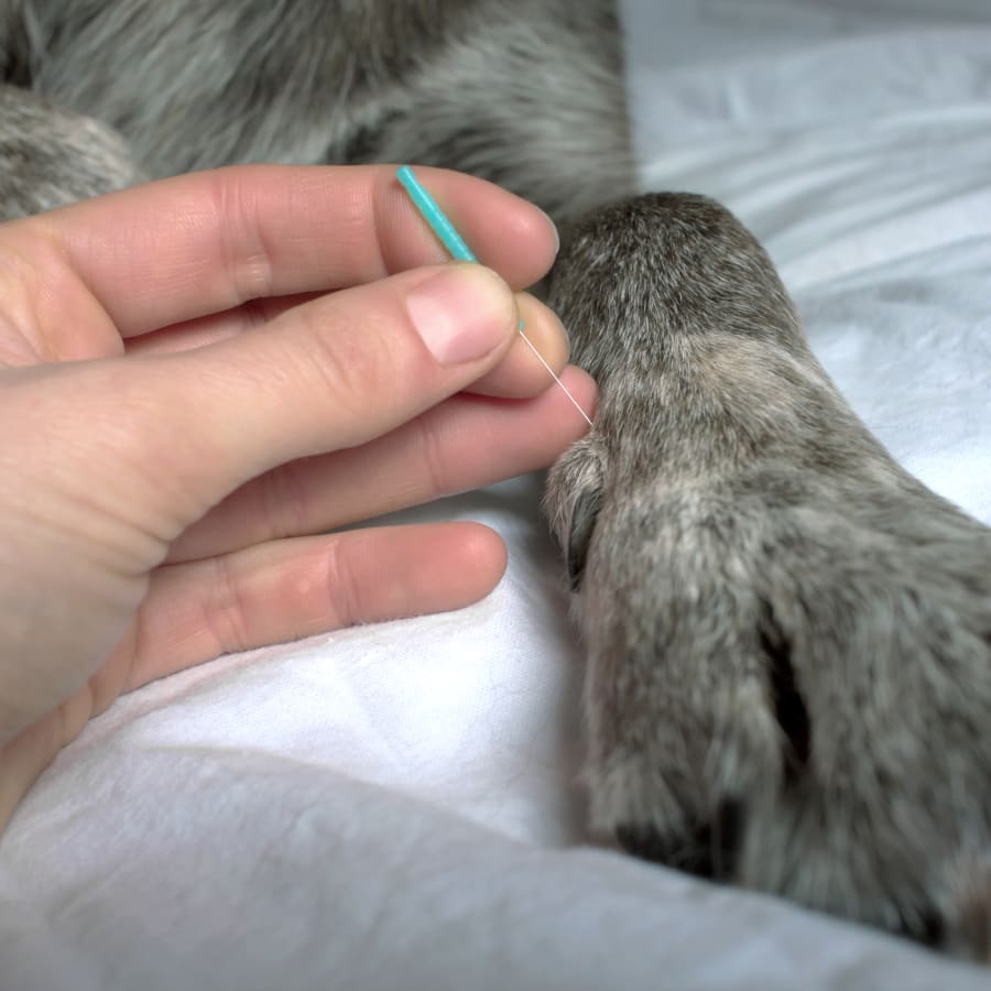 Acupuncture, Los Angeles